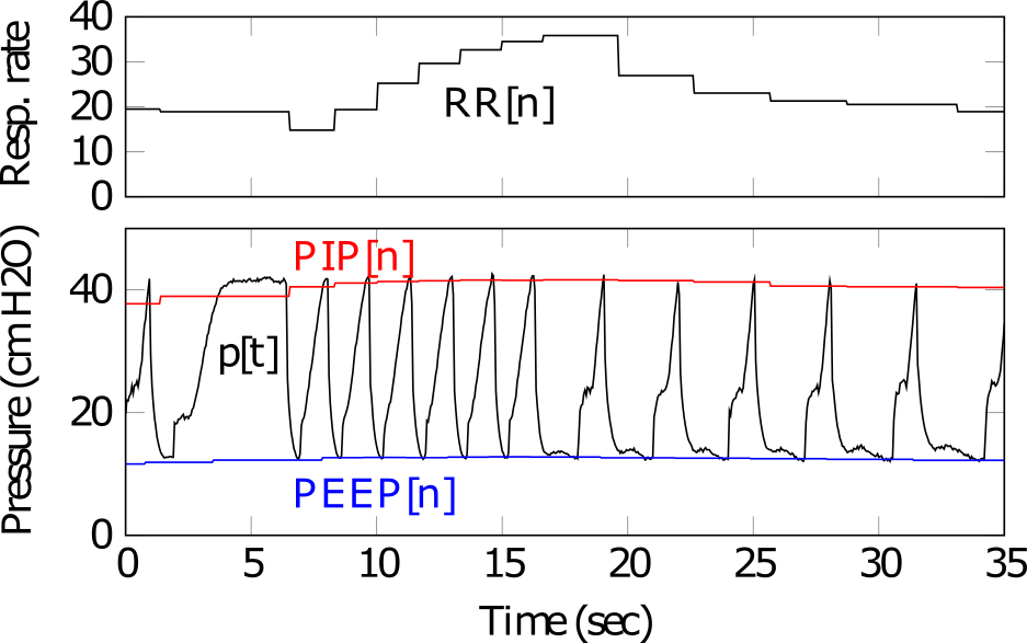 Pressure and respiratory rate waveforms