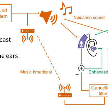 Use a wireless broadcast system to subtract unwanted noise at the ears 